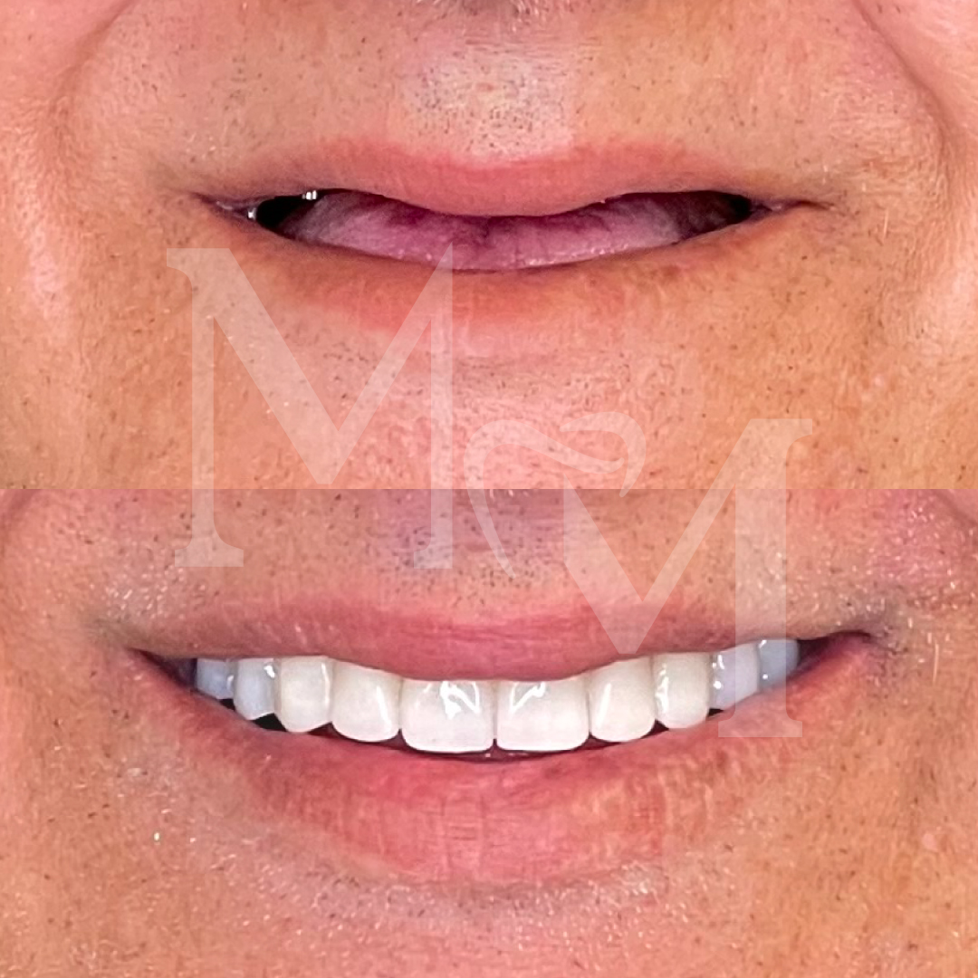 https://albania.mm-turismodentale.com/wp-content/uploads/2023/05/before-after-01.jpg