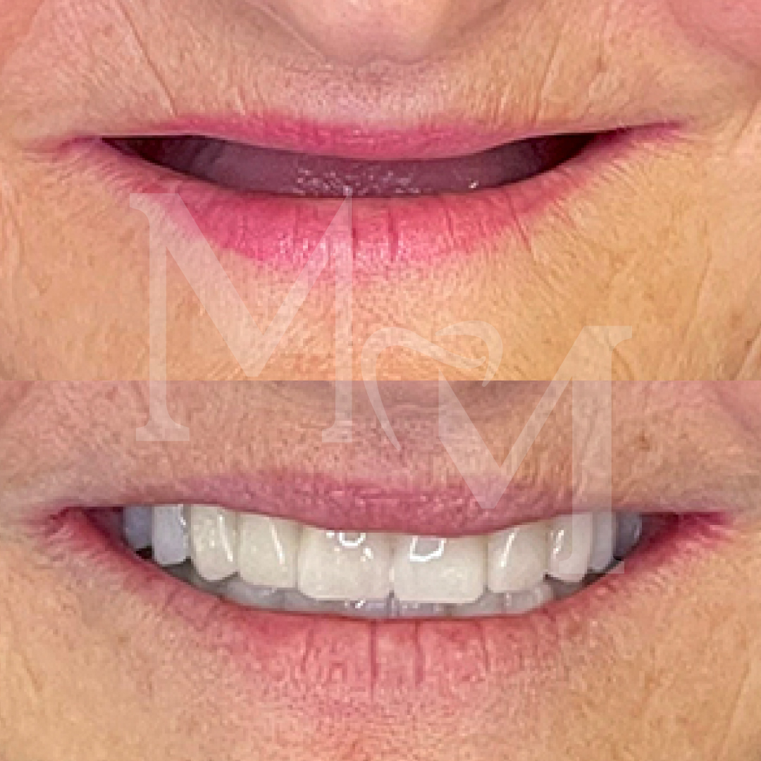 https://albania.mm-turismodentale.com/wp-content/uploads/2023/05/before-after-02.jpg