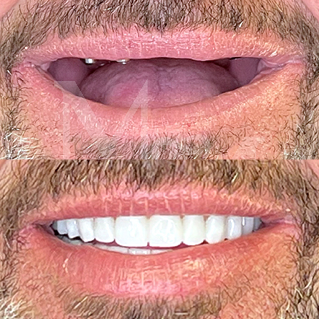 https://albania.mm-turismodentale.com/wp-content/uploads/2023/05/before-after-03.jpg